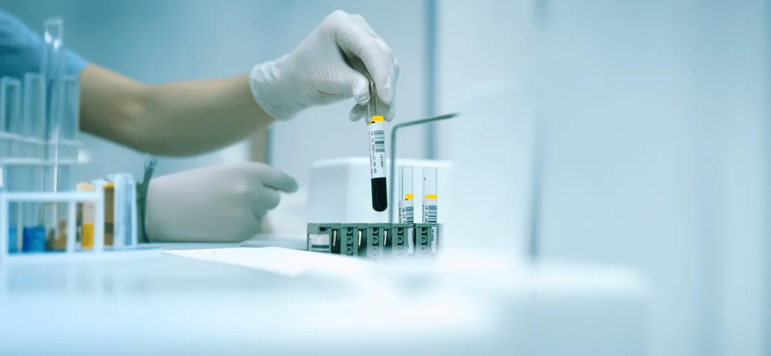 Labordiagnostik & medizinische Analyse